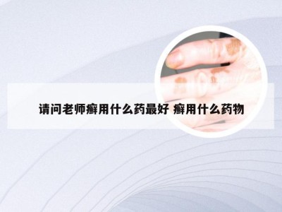 请问老师癣用什么药最好 癣用什么药物