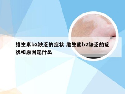 维生素b2缺乏的症状 维生素b2缺乏的症状和原因是什么