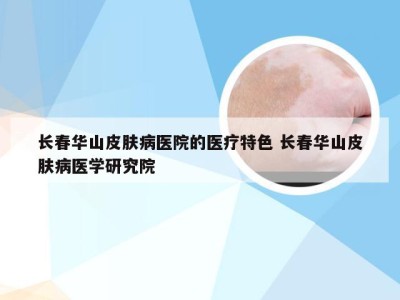 长春华山皮肤病医院的医疗特色 长春华山皮肤病医学研究院