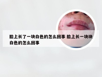 脸上长了一块白色的怎么回事 脸上长一块块白色的怎么回事