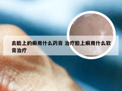 去脸上的癣用什么药膏 治疗脸上癣用什么软膏治疗