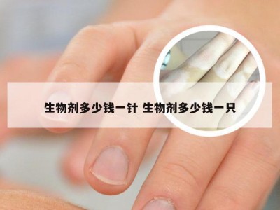 生物剂多少钱一针 生物剂多少钱一只