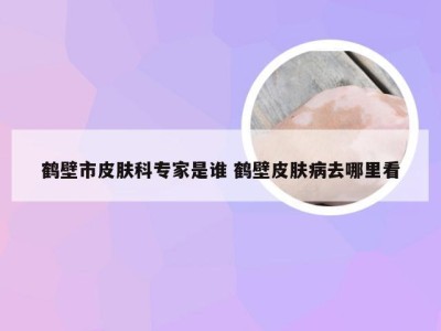 鹤壁市皮肤科专家是谁 鹤壁皮肤病去哪里看