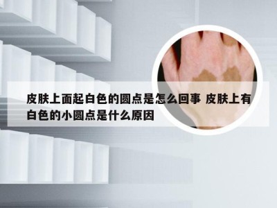 皮肤上面起白色的圆点是怎么回事 皮肤上有白色的小圆点是什么原因