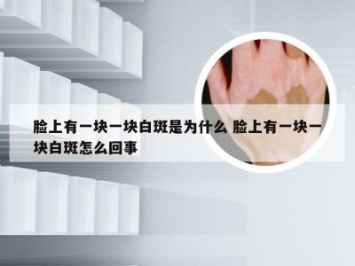 脸上有一块一块白斑是为什么 脸上有一块一块白斑怎么回事