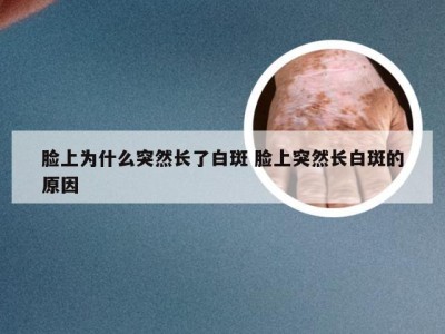 脸上为什么突然长了白斑 脸上突然长白斑的原因