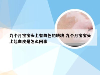 九个月宝宝头上有白色的块块 九个月宝宝头上起白皮是怎么回事