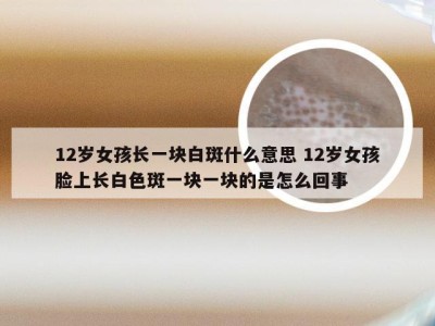 12岁女孩长一块白斑什么意思 12岁女孩脸上长白色斑一块一块的是怎么回事