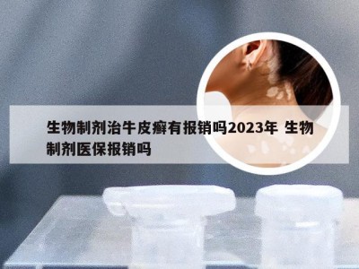 生物制剂治牛皮癣有报销吗2023年 生物制剂医保报销吗