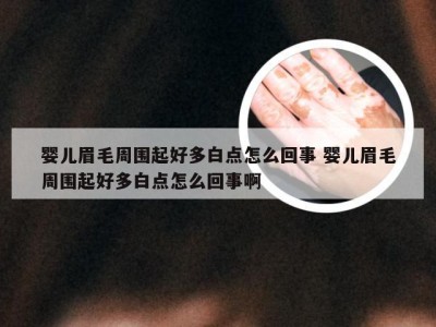 婴儿眉毛周围起好多白点怎么回事 婴儿眉毛周围起好多白点怎么回事啊