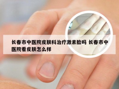 长春市中医院皮肤科治疗激素脸吗 长春市中医院看皮肤怎么样