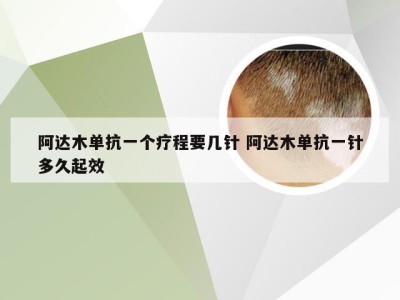 阿达木单抗一个疗程要几针 阿达木单抗一针多久起效