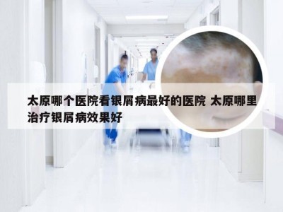 太原哪个医院看银屑病最好的医院 太原哪里治疗银屑病效果好