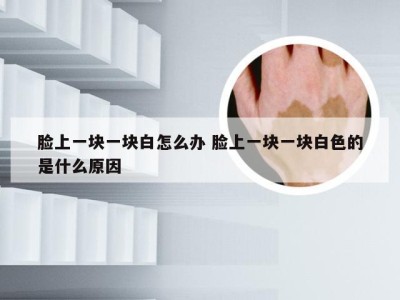 脸上一块一块白怎么办 脸上一块一块白色的是什么原因