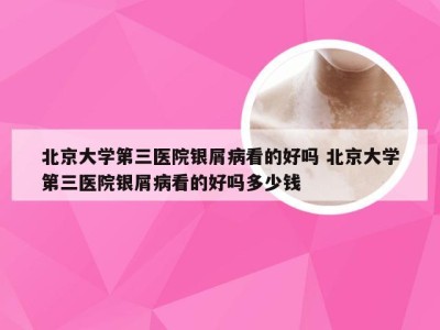 北京大学第三医院银屑病看的好吗 北京大学第三医院银屑病看的好吗多少钱