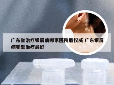 广东省治疗银屑病哪家医院最权威 广东银屑病哪里治疗最好