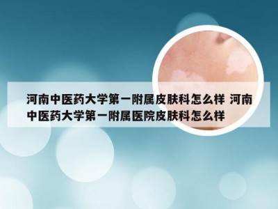 河南中医药大学第一附属皮肤科怎么样 河南中医药大学第一附属医院皮肤科怎么样