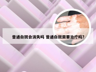 普通白斑会消失吗 普通白斑需要治疗吗?