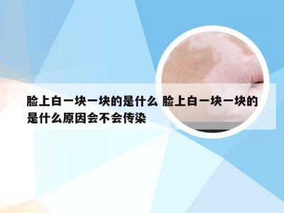 脸上白一块一块的是什么 脸上白一块一块的是什么原因会不会传染