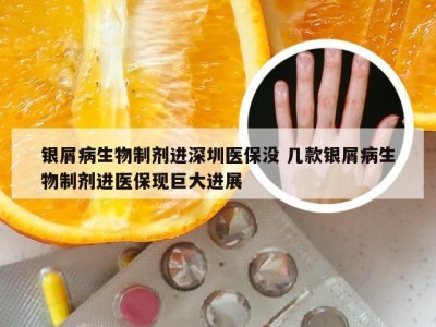 银屑病生物制剂进深圳医保没 几款银屑病生物制剂进医保现巨大进展