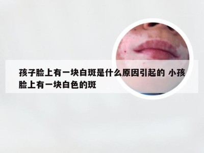 孩子脸上有一块白斑是什么原因引起的 小孩脸上有一块白色的斑