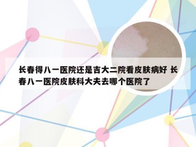 长春得八一医院还是吉大二院看皮肤病好 长春八一医院皮肤科大夫去哪个医院了