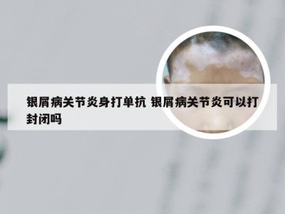 银屑病关节炎身打单抗 银屑病关节炎可以打封闭吗