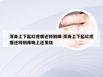 浑身上下起红疙瘩还特别痒 浑身上下起红疙瘩还特别痒晚上还发烧