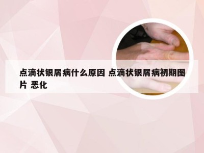 点滴状银屑病什么原因 点滴状银屑病初期图片 恶化