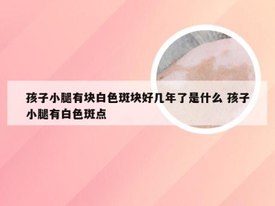 孩子小腿有块白色斑块好几年了是什么 孩子小腿有白色斑点