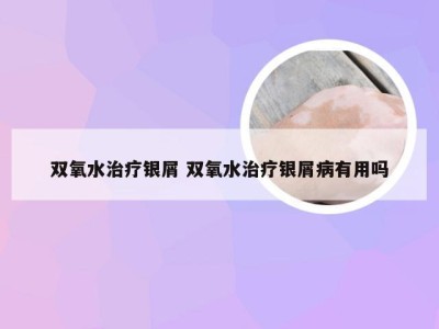 双氧水治疗银屑 双氧水治疗银屑病有用吗