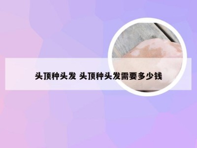 头顶种头发 头顶种头发需要多少钱