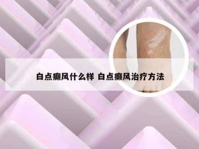 白点癫风什么样 白点癫风治疗方法