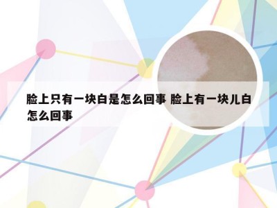 脸上只有一块白是怎么回事 脸上有一块儿白怎么回事