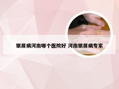 银屑病河南哪个医院好 河南银屑病专家