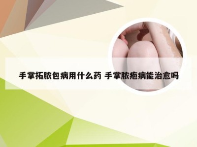 手掌拓脓包病用什么药 手掌脓疱病能治愈吗