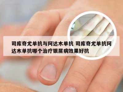 司库奇尤单抗与阿达木单抗 司库奇尤单抗阿达木单抗哪个治疗银屑病效果好抗