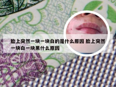 脸上突然一块一块白的是什么原因 脸上突然一块白一块黑什么原因