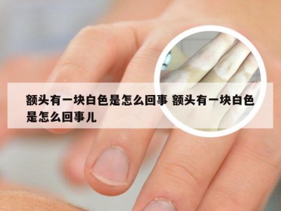 额头有一块白色是怎么回事 额头有一块白色是怎么回事儿