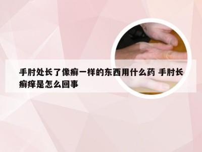 手肘处长了像癣一样的东西用什么药 手肘长癣痒是怎么回事