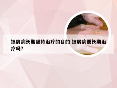 银屑病长期坚持治疗的目的 银屑病要长期治疗吗?