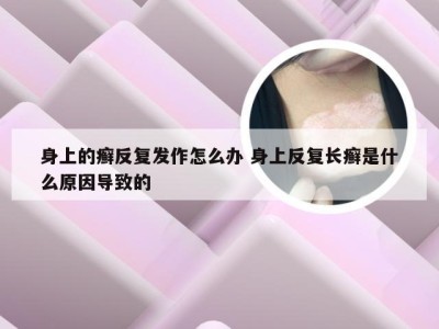 身上的癣反复发作怎么办 身上反复长癣是什么原因导致的