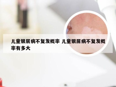 儿童银屑病不复发概率 儿童银屑病不复发概率有多大