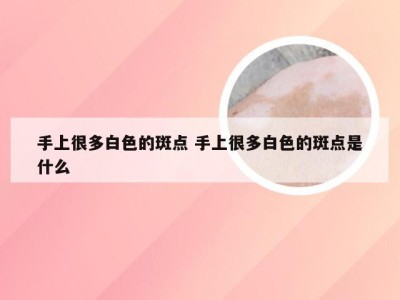 手上很多白色的斑点 手上很多白色的斑点是什么