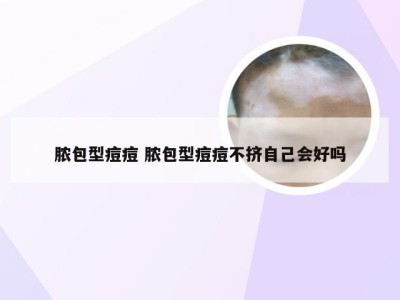 脓包型痘痘 脓包型痘痘不挤自己会好吗