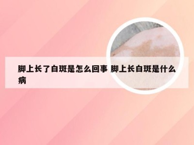 脚上长了白斑是怎么回事 脚上长白斑是什么病