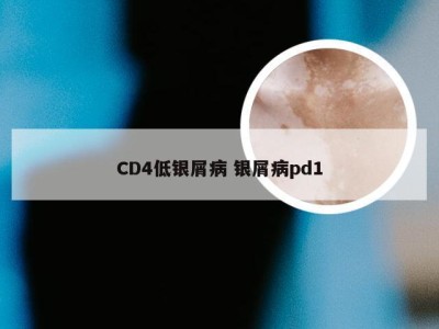 CD4低银屑病 银屑病pd1