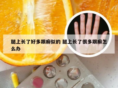 腿上长了好多跟癣似的 腿上长了很多跟癣怎么办