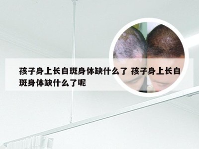 孩子身上长白斑身体缺什么了 孩子身上长白斑身体缺什么了呢