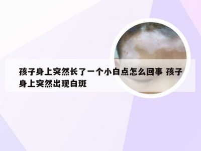 孩子身上突然长了一个小白点怎么回事 孩子身上突然出现白斑